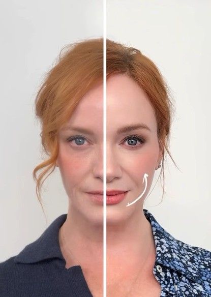 christina hendricks before and after cosmetic procedure trilift