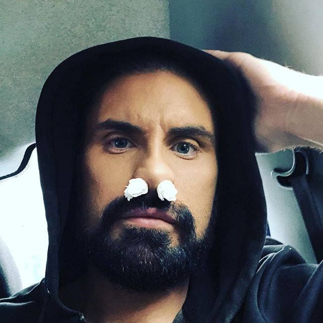Rylan Clark with tissue up his nose to stop his hay fever symptoms