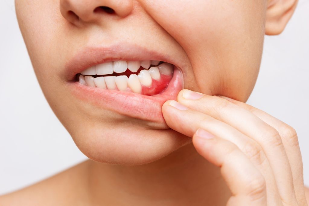 Cropped shot of a young woman showing red bleeding gums isolated on a white background