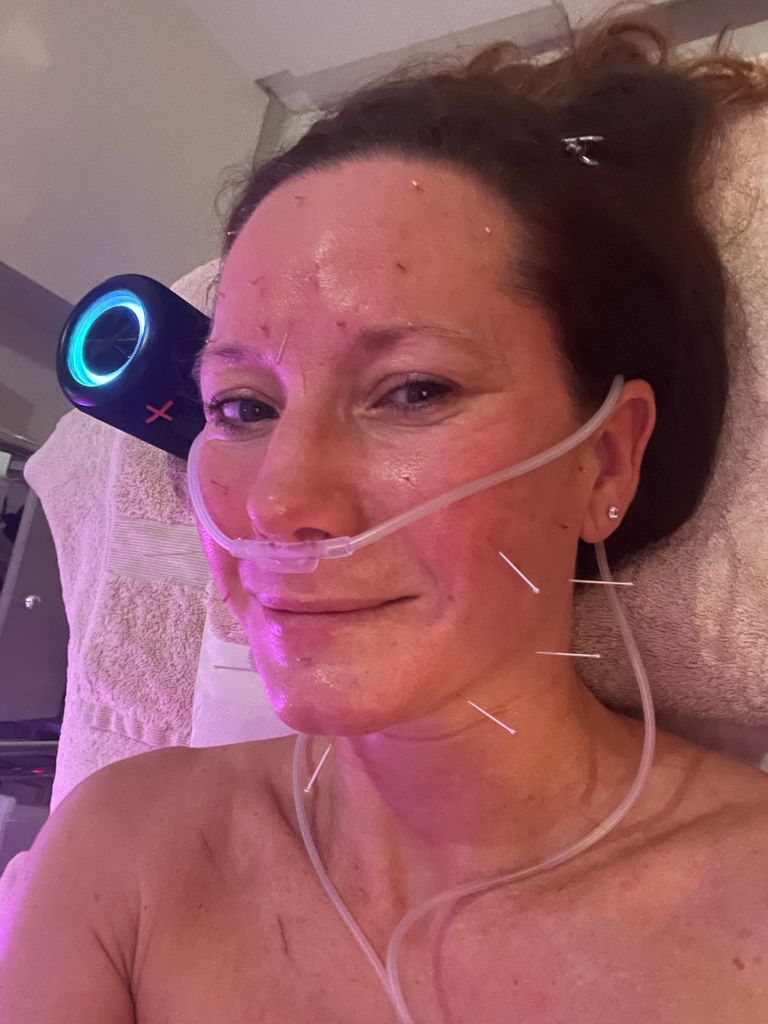 Releasing Grief With Accupuncture Facial at Sarah Bradden