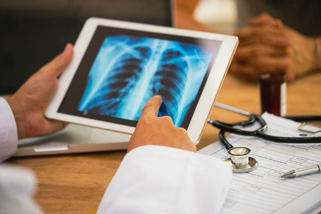  lung cancer screening xray.