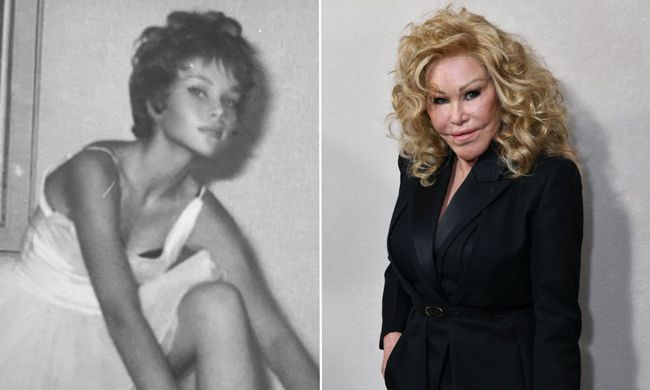 catwoman jocelyn wildenstein before and after surgery