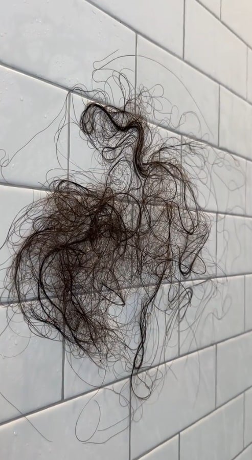 Hair loss from Sophia Umansky