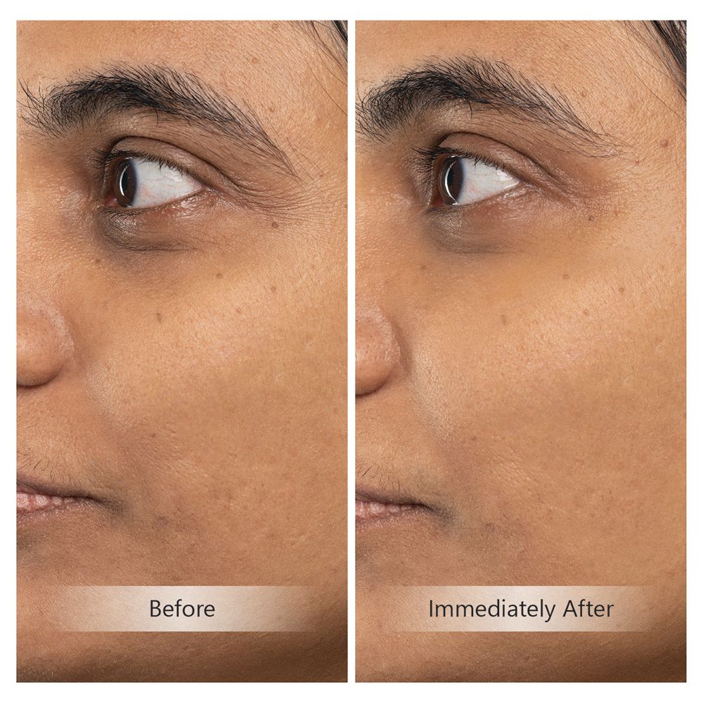 invity serum before and after