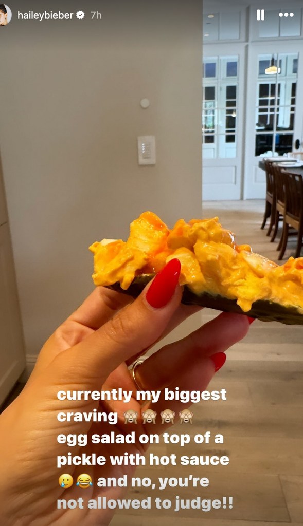 Hailey shares her unusual pregnancy craving