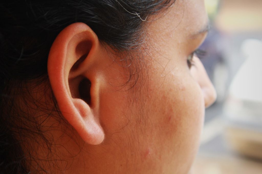 Once-plump earlobes appear thinner, longer, or even droopy