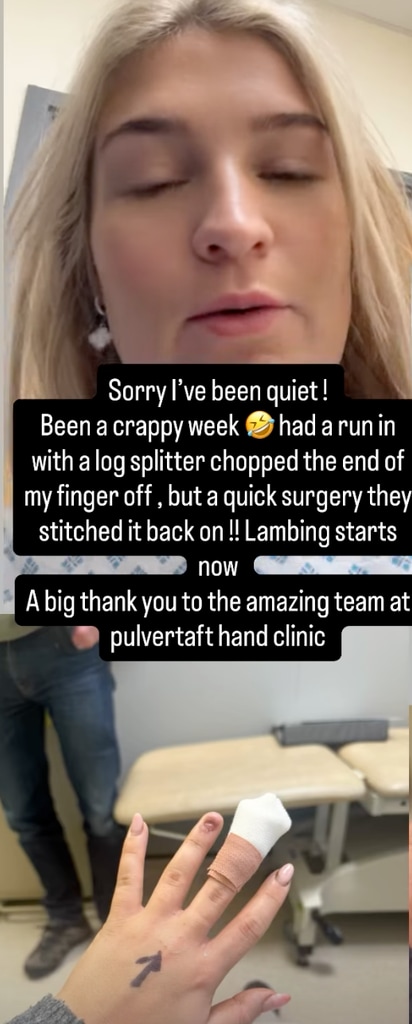 La star de Clarkson's Farm, Harriet Cowan, subit une intervention chirurgicale après une horrible blessure 1 Harriet Cowan révèle une horrible blessure