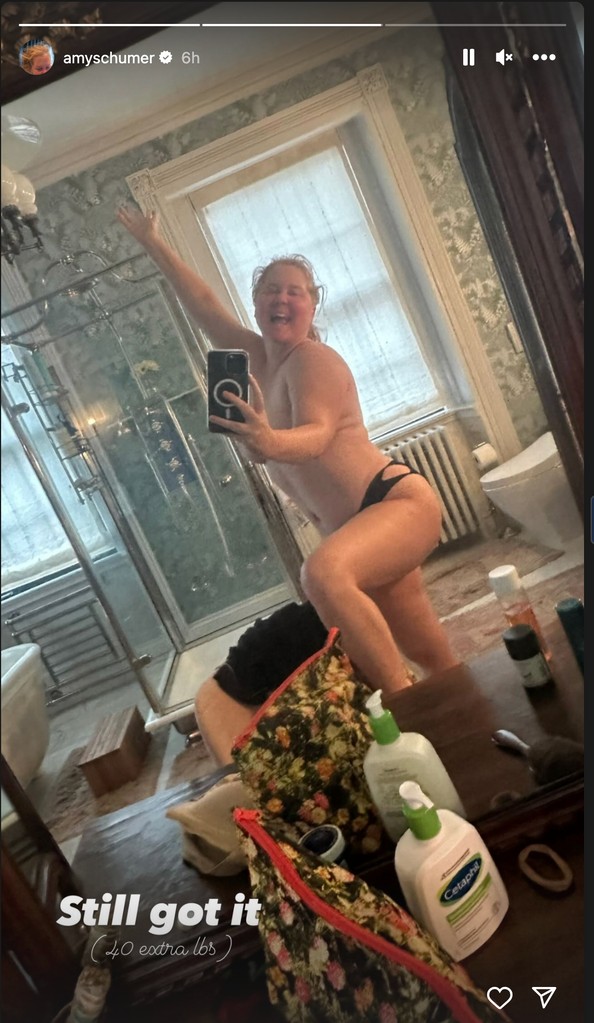 Amy Schumer posts racy pic