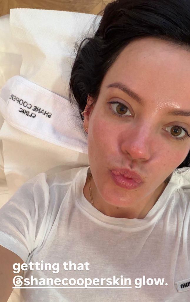 Lily Allen often has facials by Shane Cooper which keeps her skin looking fresh