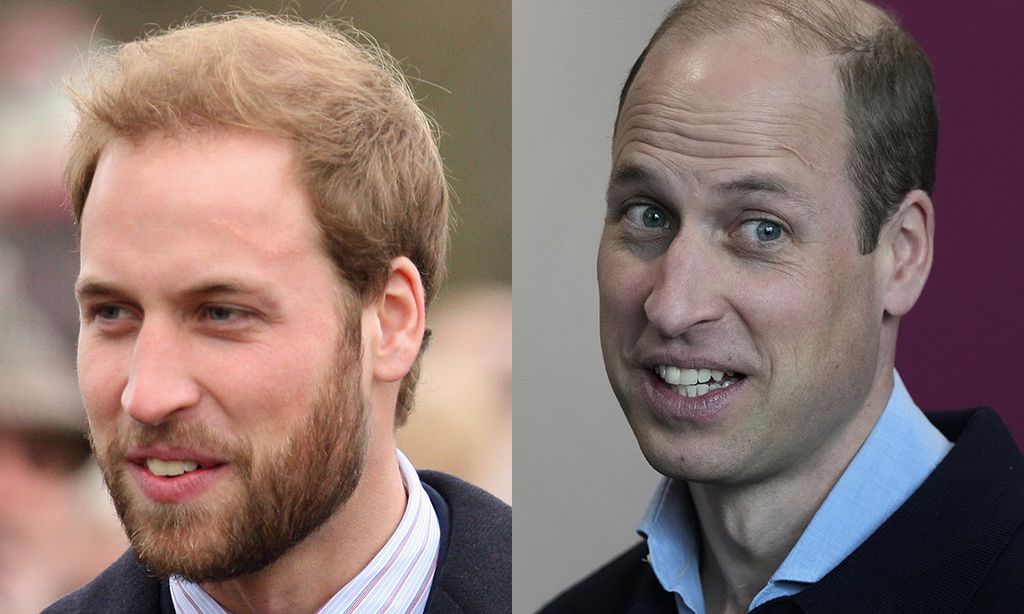 Split image of Prince William with and without a beard