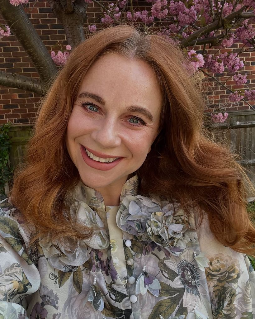 My teeth before were not awful by any means, but they were slightly crooked at the sides and the bottom set were a little overcrowded