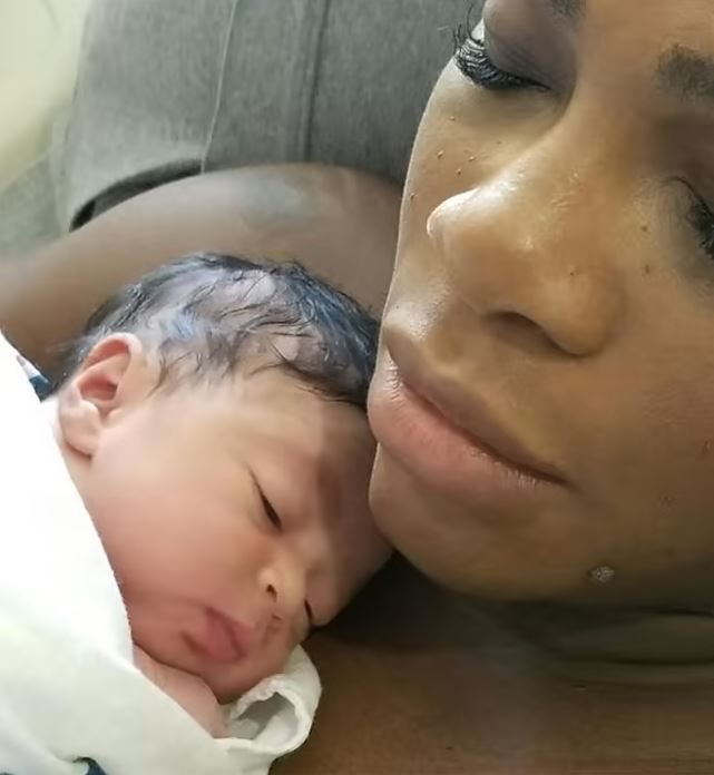 serena williams breastfeeding
