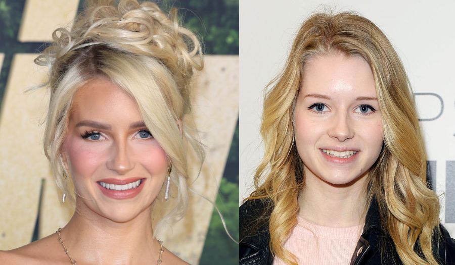 Side by side photo of Lottie Moss before and after her smile makeover