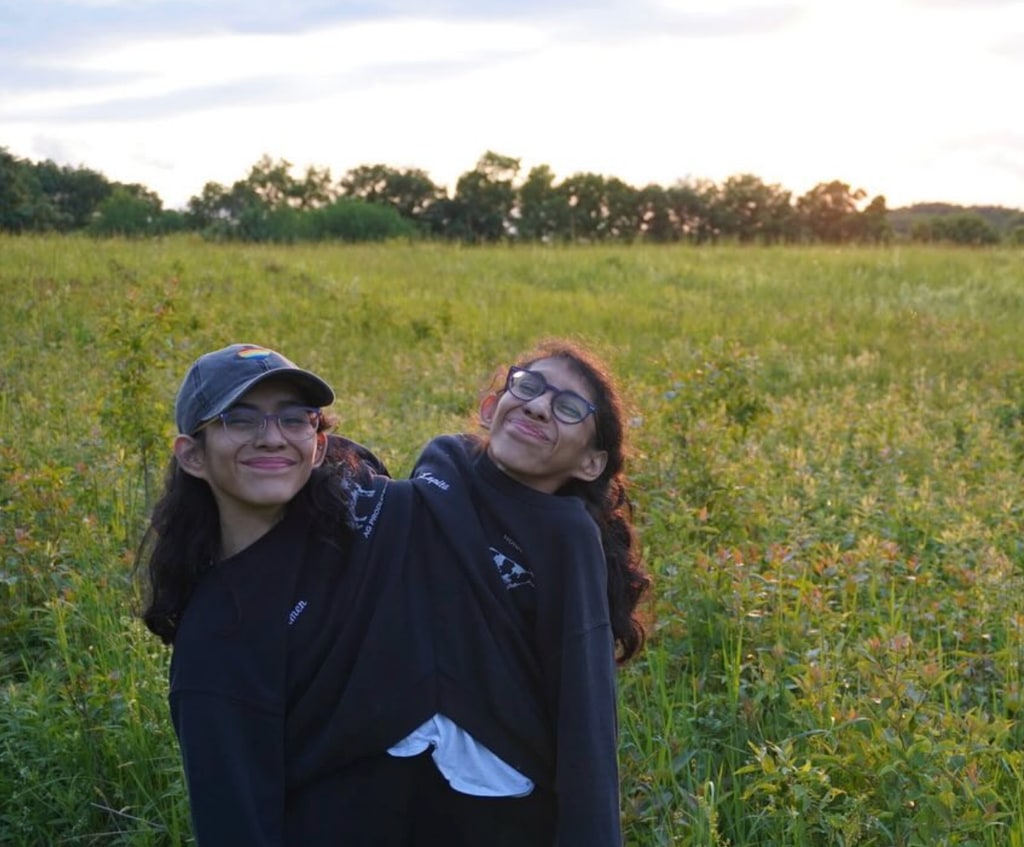 Conjoined twins Carmen and Lupita Andrade