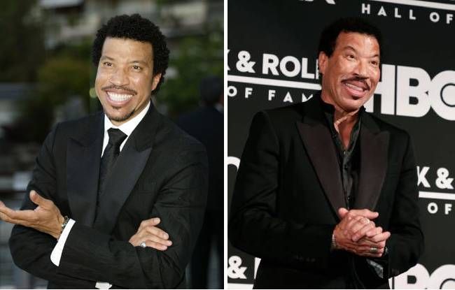 lionel richie before and after