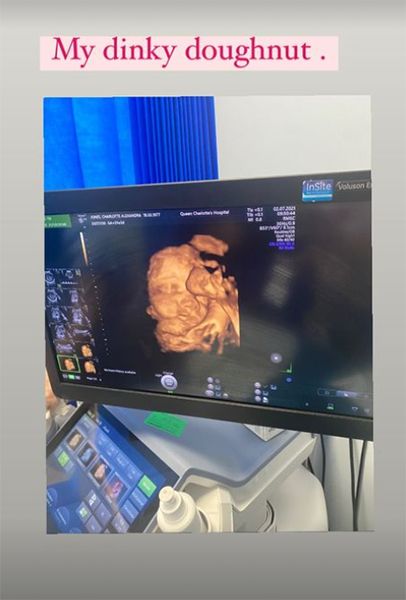 alex jones pregnancy scan