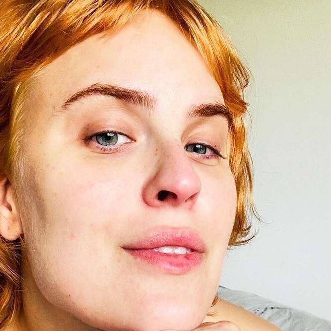 tallulah willis photo of face amid skin picking disorder