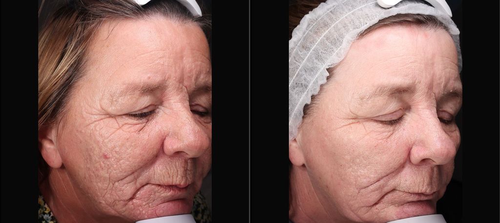 side by side photo of woman's face close up