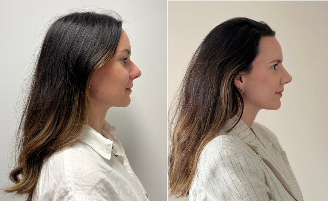 side profile of face