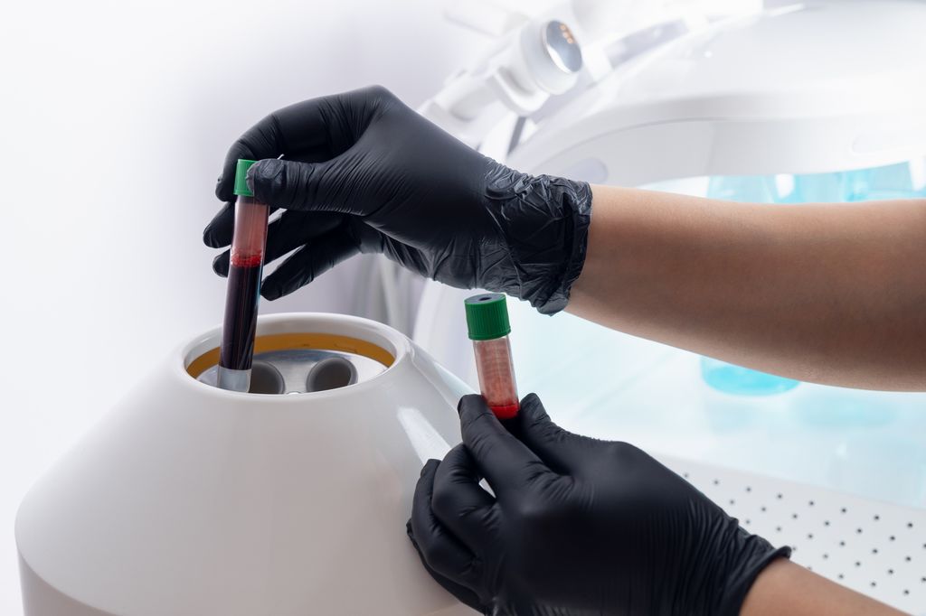 échange plasmatique thérapeutique 