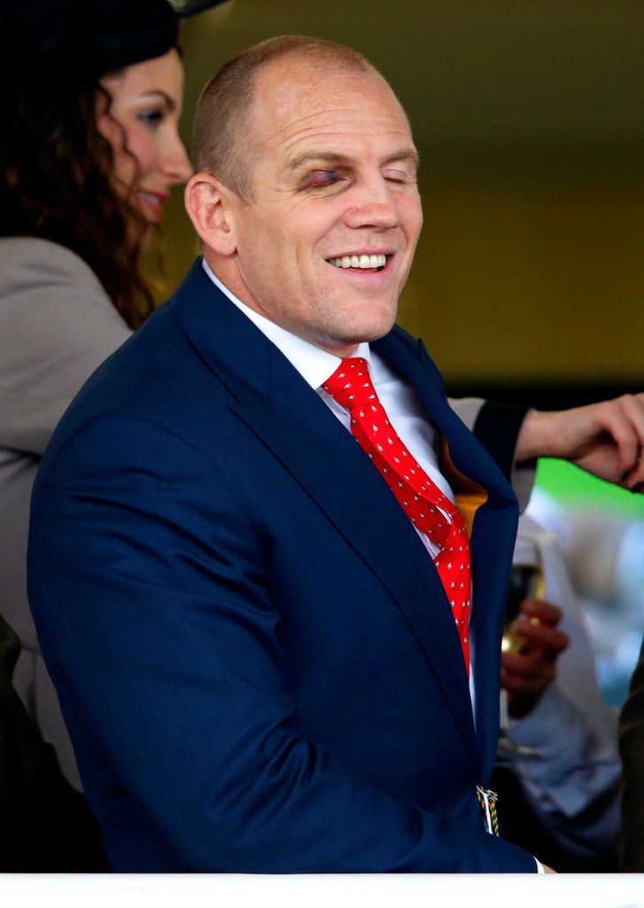 Mike Tindall sports a black eye after a rugby injury