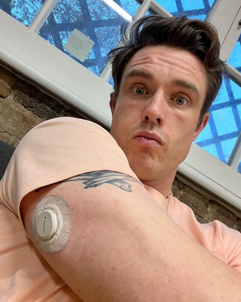 Ed Gamble showing his dexcom diabetes monitor