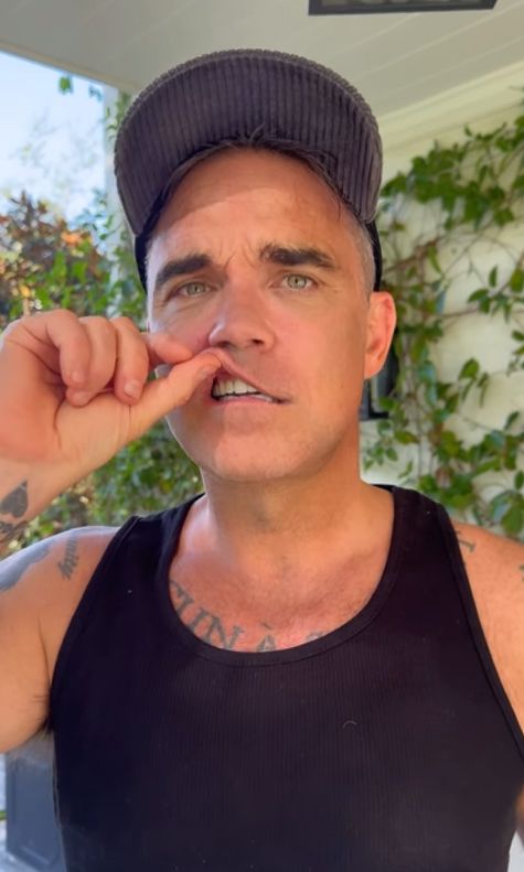 Robbie Williams pulling up his top lip to show off a set of white teeth