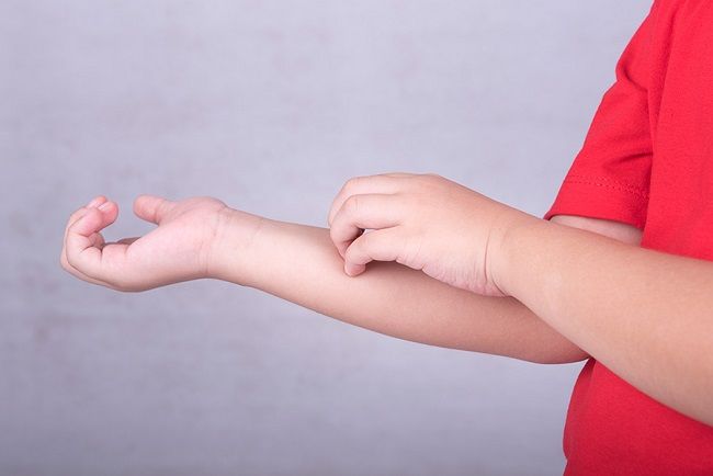 eczema child scratching arm