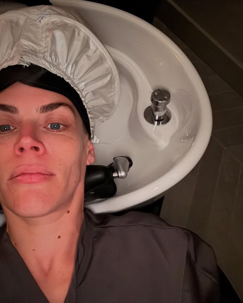 Busy Philipps shared a photo of her latest beauty treatment with her social media followers 
