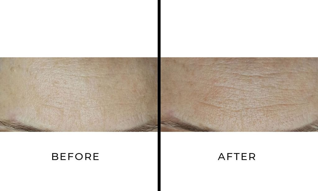 Lyma Skincare Before and After