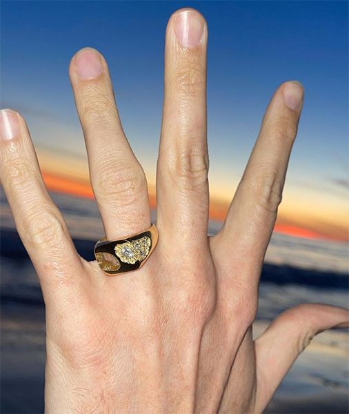 nick grimshaw engagement ring