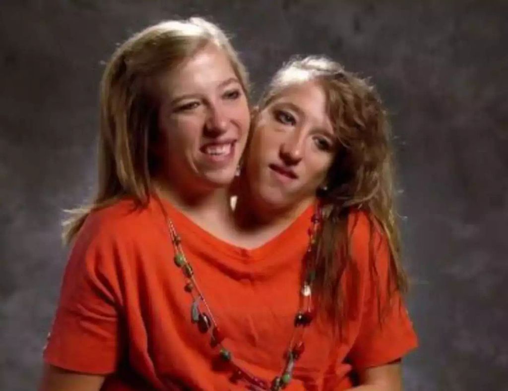 Conjoined twins Abby and Brittany Hensel talk challenge in personal ...
