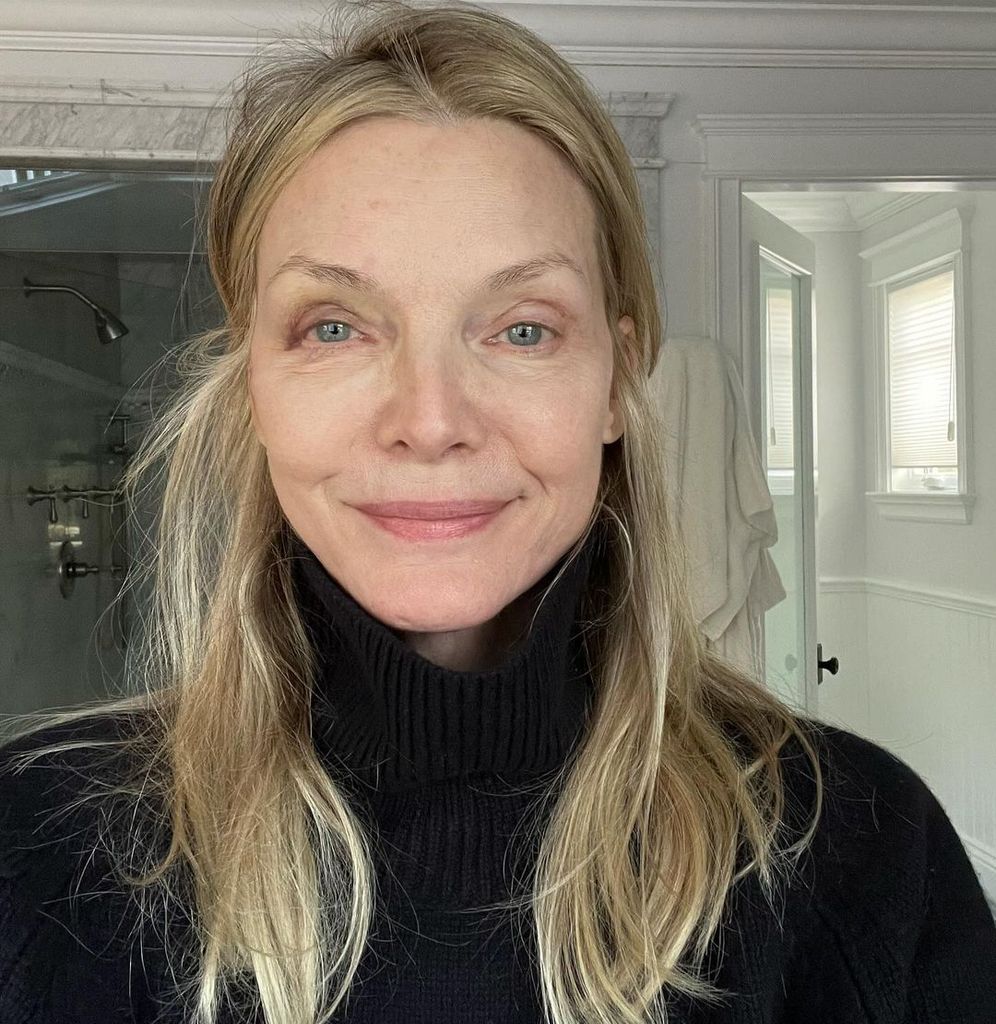 Michelle Pfeiffer poses for selfie with black eye