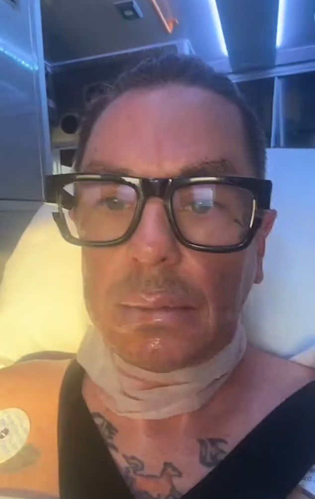 sid wilson in hospital with serious burns after fire explosion at family farm