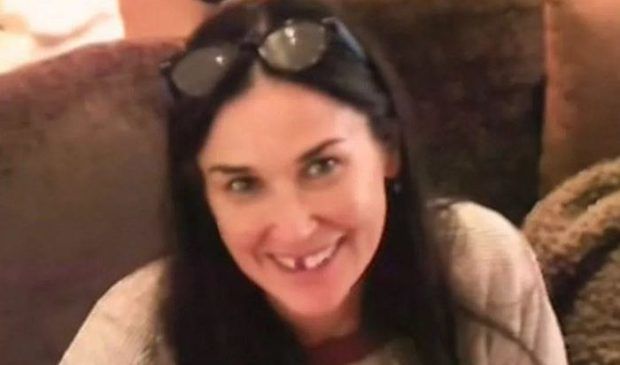 demi moore missing teeth