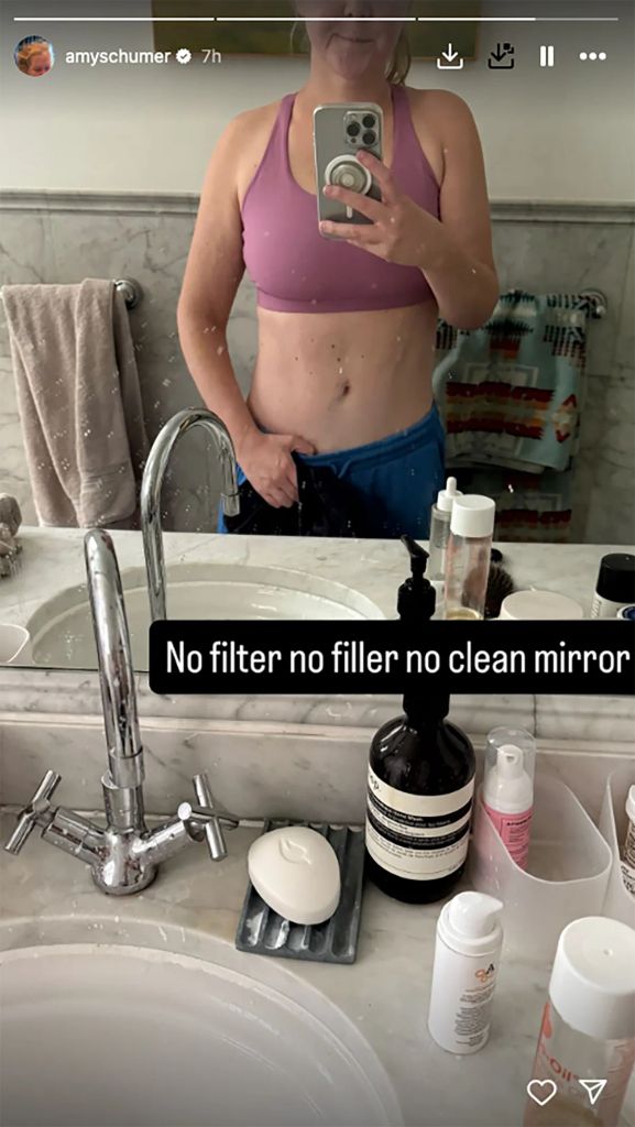 Amy Schumer showcases her incredibly taut stomach
