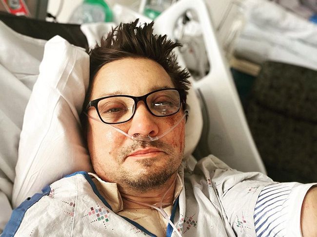Jeremy Renner showcases bruised and scratched face after the accident
