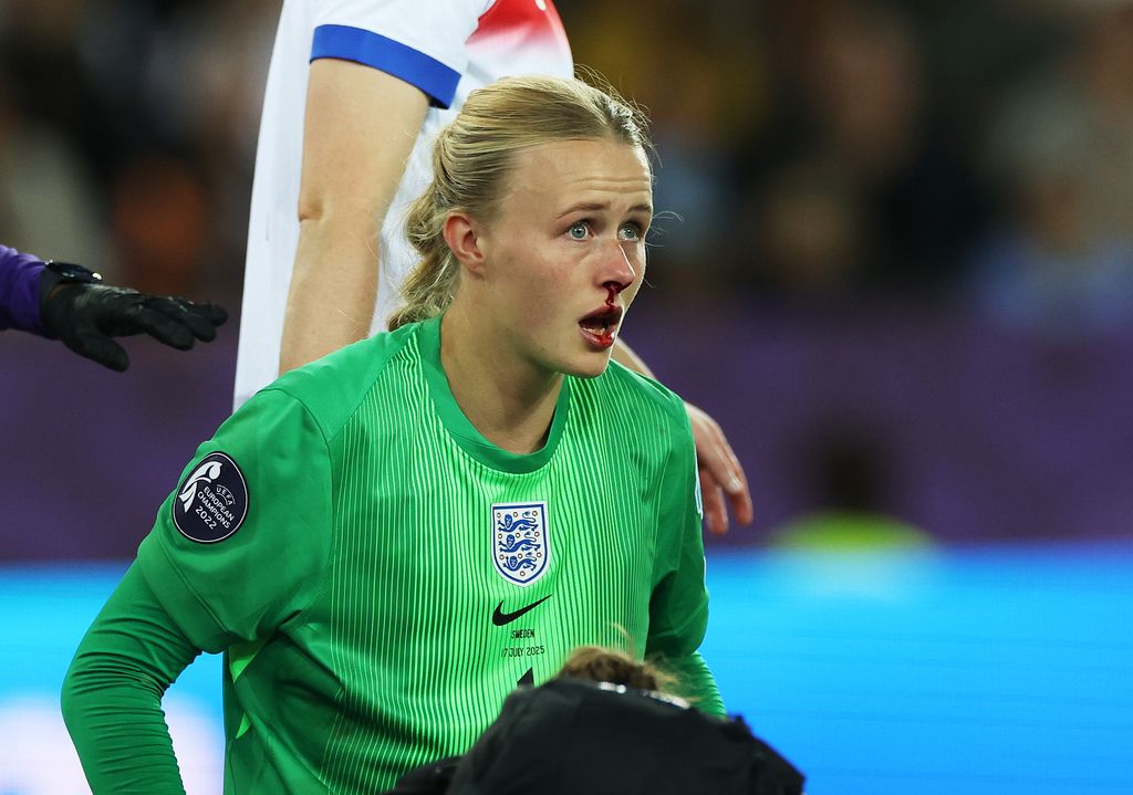 Hannah Hampton playing football with a nosebleed
