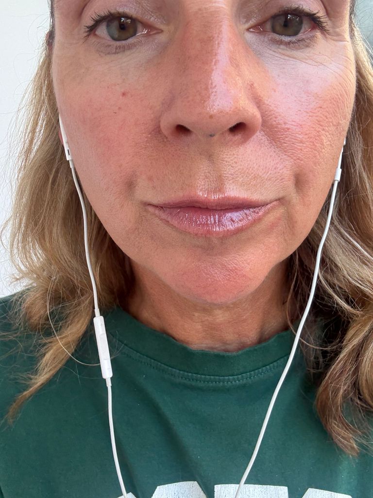 close up selfie of a woman's lips after lip filler