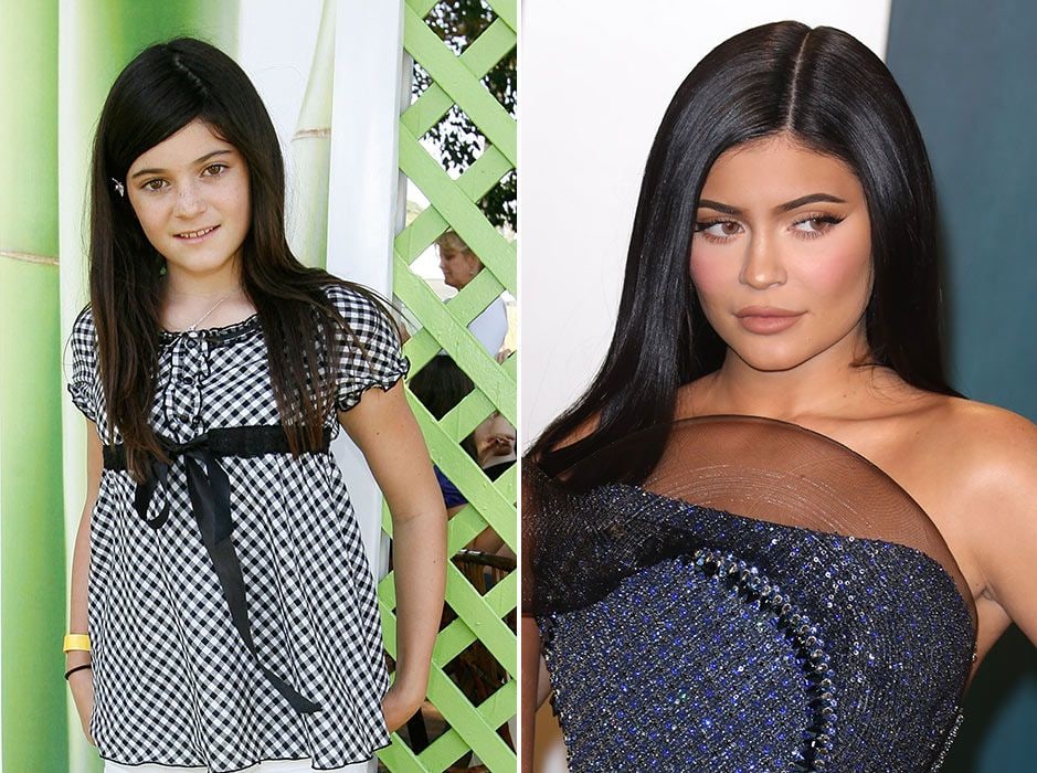 kylie then and now