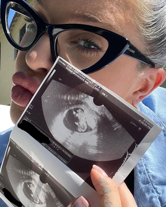 Kelly Osbourne showing an ultrasound photo of her unborn child