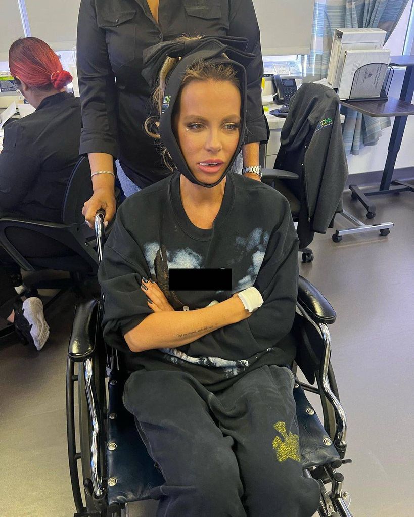 Kate Beckinsale stunned fans with photo in a wheelchair following dental surgery