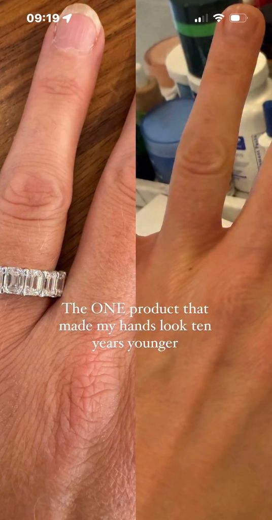Fans flocked to the comments section to find out the exact product the influencer used to get her hands looking 10 years younger