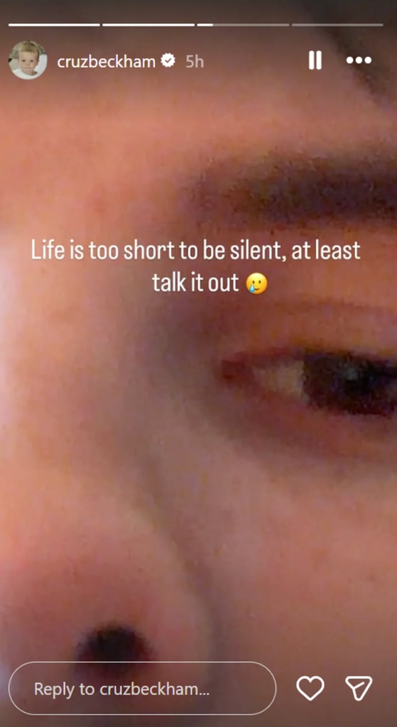 A close up photo of Cruz Beckham's eye