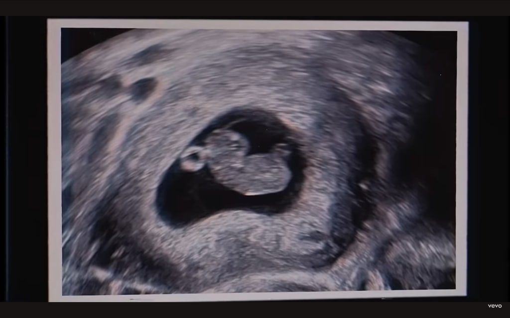 A sonogram shared by Hailie Jade Scott-McClintock, featured in Eminem's new music video for "Temporary"