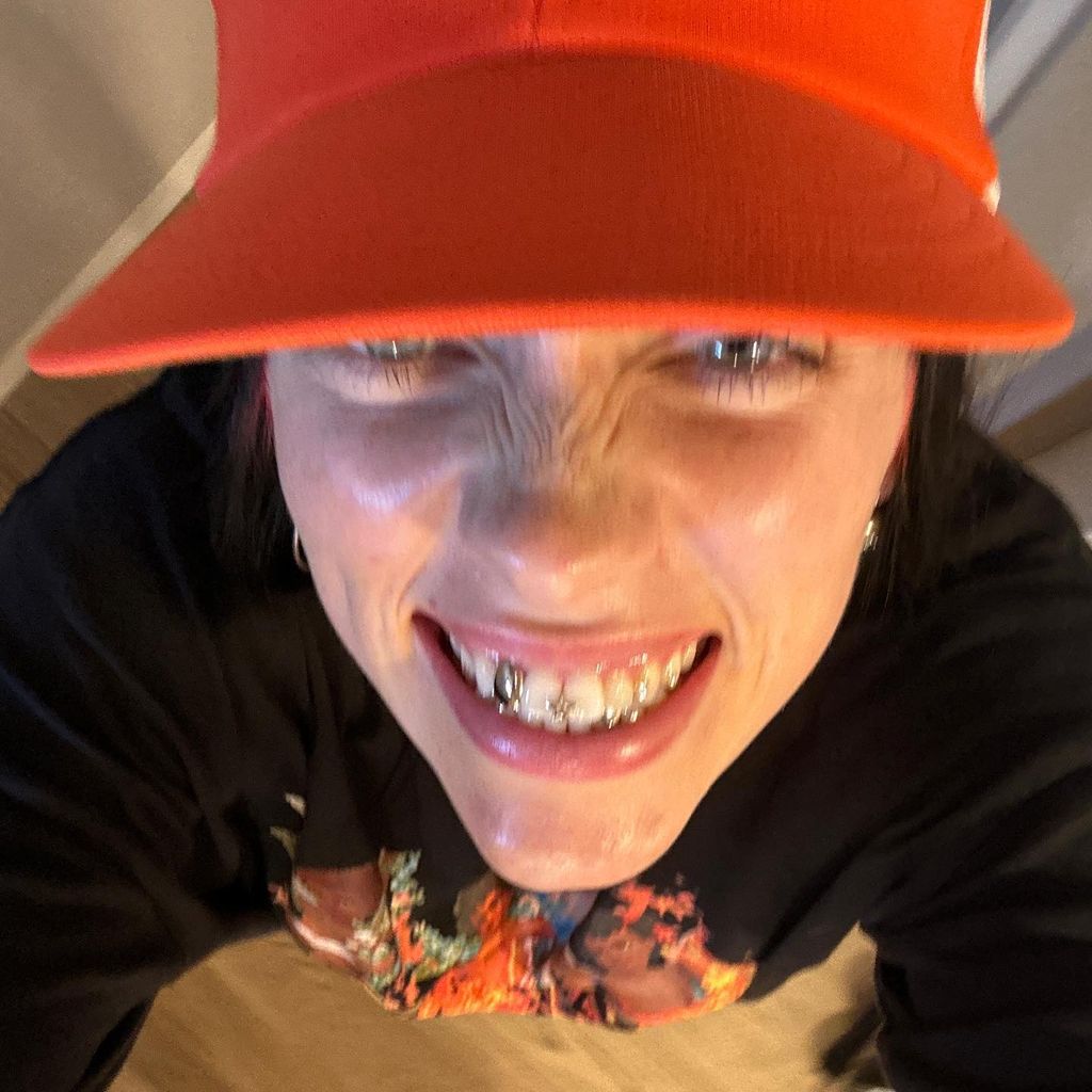 Billie Eilish divides fans with teeth transformation – see photos | HELLO!