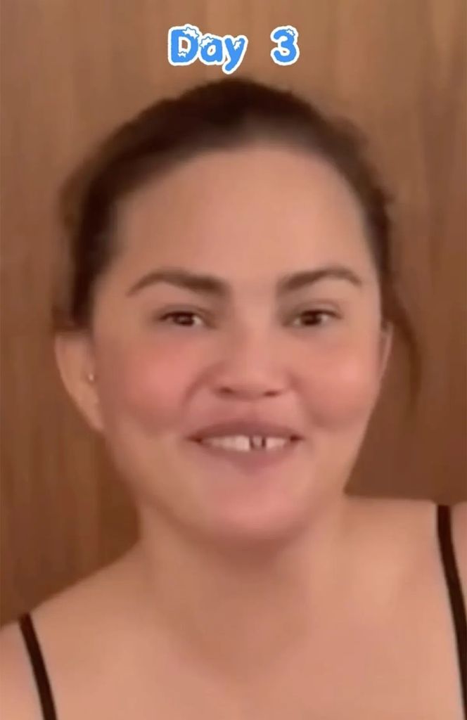 photo of chrissy teigen with missing tooth