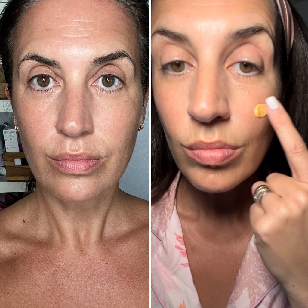 Donna's 7 day sober skin transformation 