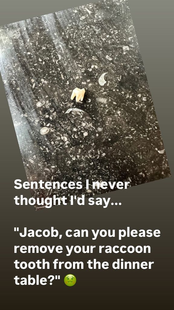 Carrie Underwood shares a picture of her son Jacob's raccoon tooth on their dinner table, posted on Instagram Stories