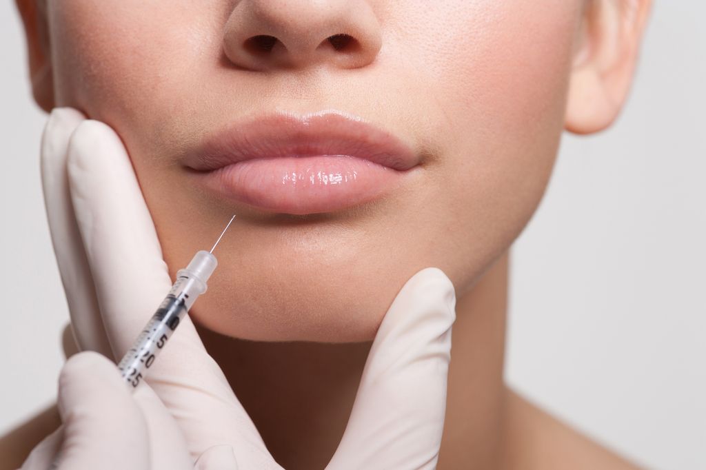 Filler fatigue can happen if you overdo injectables